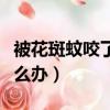 被花斑蚊咬了怎么办小妙招（被花斑蚊咬了怎么办）