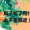 蚊子咬了用什么不留痕迹消除（蚊子咬了用什么不留痕迹）